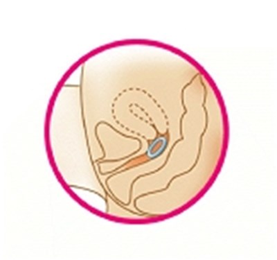 Image Of Diagram 6 (Diagram 6)
